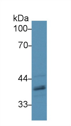 Polyclonal Antibody to ATPase, H+ Transporting, Lysosomal Accessory Protein 2 (ATP6AP2)