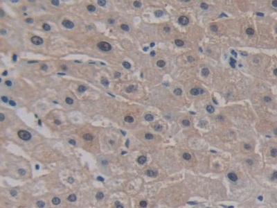 Polyclonal Antibody to Cadherin EGF LAG Seven Pass G-Type Receptor 3 (CELSR3)