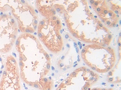 Polyclonal Antibody to Desmocollin 1 (DSC1)