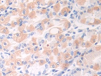 Polyclonal Antibody to Desmocollin 1 (DSC1)