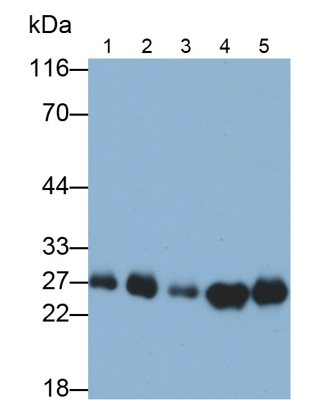 Polyclonal Antibody to Calbindin (CALB)