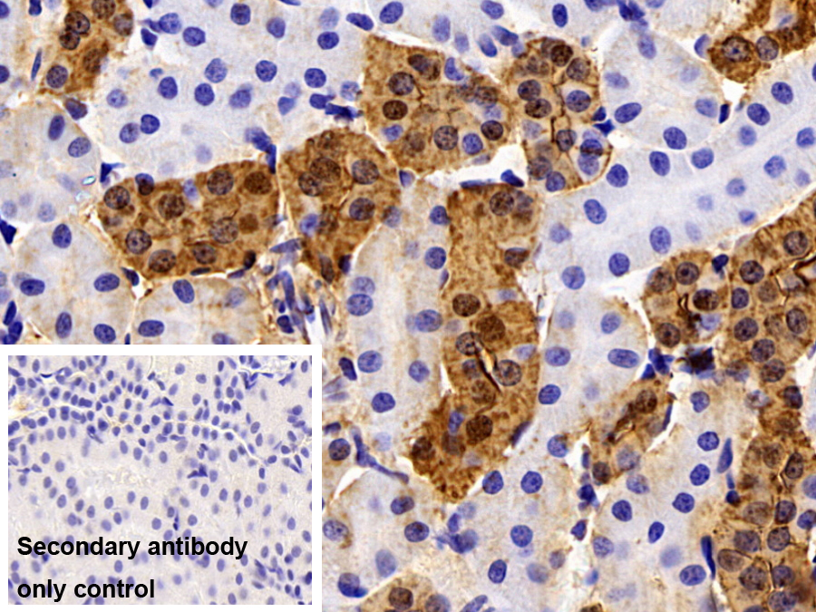 Polyclonal Antibody to Calbindin (CALB)