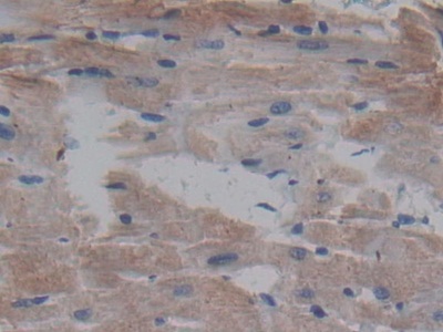 Polyclonal Antibody to Cerebral Dopamine Neurotrophic Factor (CDNF)