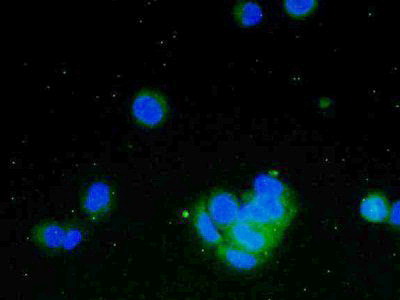 Polyclonal Antibody to Cerebral Dopamine Neurotrophic Factor (CDNF)