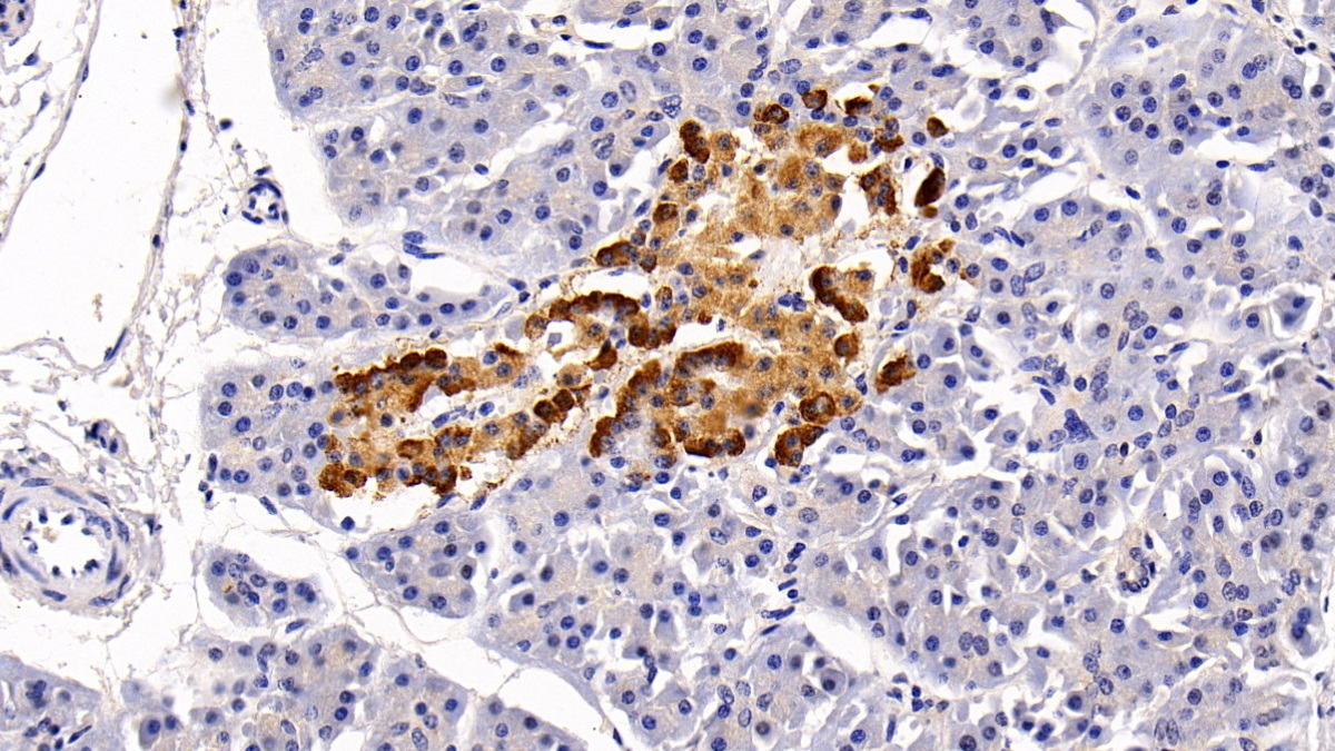 Polyclonal Antibody to 5-Methyltetrahydrofolate Homocysteine Methyltransferase (MTR)