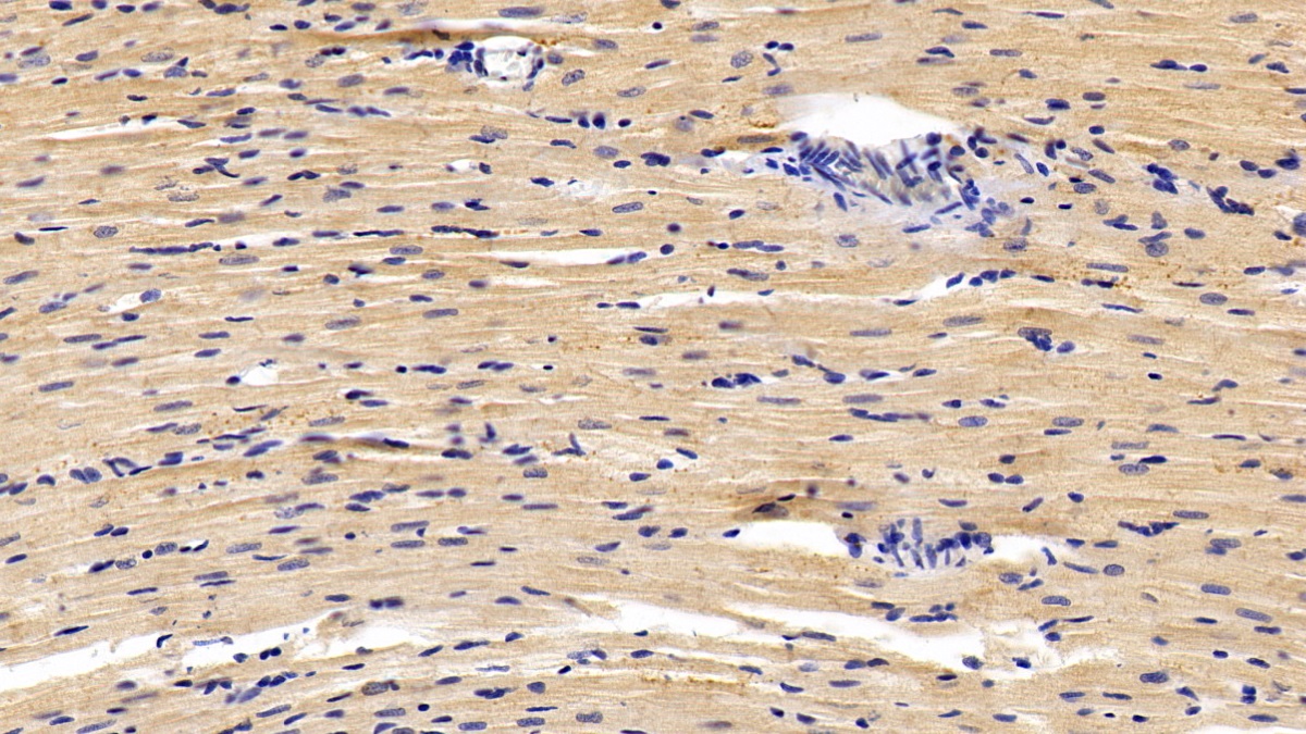 Polyclonal Antibody to 5-Methyltetrahydrofolate Homocysteine Methyltransferase (MTR)