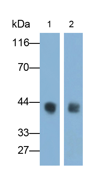 Polyclonal Antibody to Betaine Homocysteine Methyltransferase 2 (BHMT2)