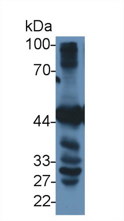 Polyclonal Antibody to Betaine Homocysteine Methyltransferase (BHMT)