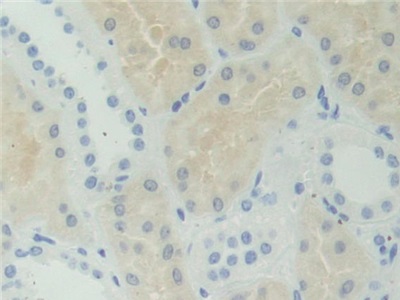 Polyclonal Antibody to Adenosylhomocysteinase (AHCY)