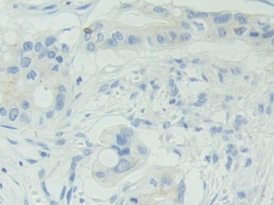 Polyclonal Antibody to Adenosylhomocysteinase (AHCY)