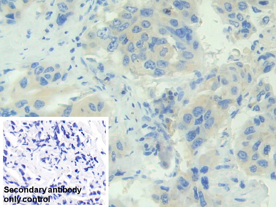 Polyclonal Antibody to Adenosylhomocysteinase (AHCY)