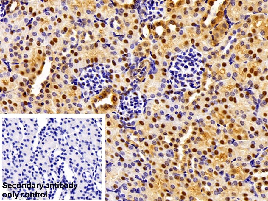 Polyclonal Antibody to Adenosylhomocysteinase (AHCY)