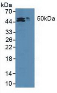 Polyclonal Antibody to Methionine Adenosyltransferase II Alpha (MAT2a)