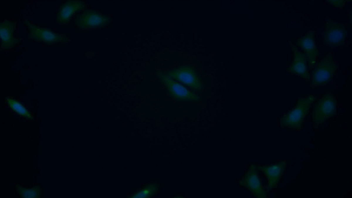 Polyclonal Antibody to Methionine Adenosyltransferase II Alpha (MAT2a)