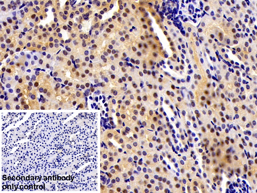 Polyclonal Antibody to Methionine Adenosyltransferase II Alpha (MAT2a)