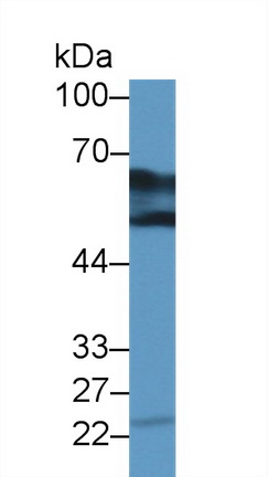 Polyclonal Antibody to Dopa Decarboxylase (DDC)