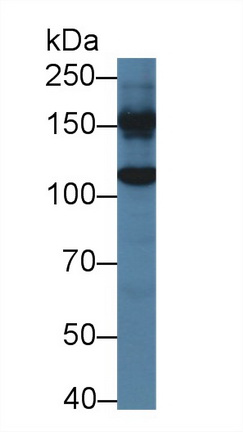 Polyclonal Antibody to Glycine Dehydrogenase (GLDC)