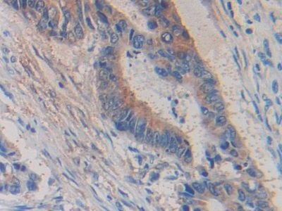 Polyclonal Antibody to Glycine Dehydrogenase (GLDC)