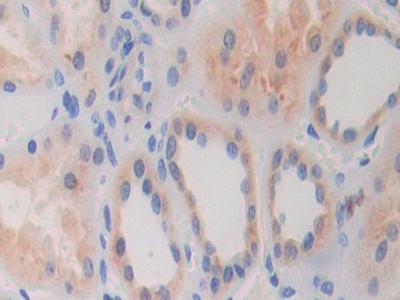 Polyclonal Antibody to Glycine Dehydrogenase (GLDC)