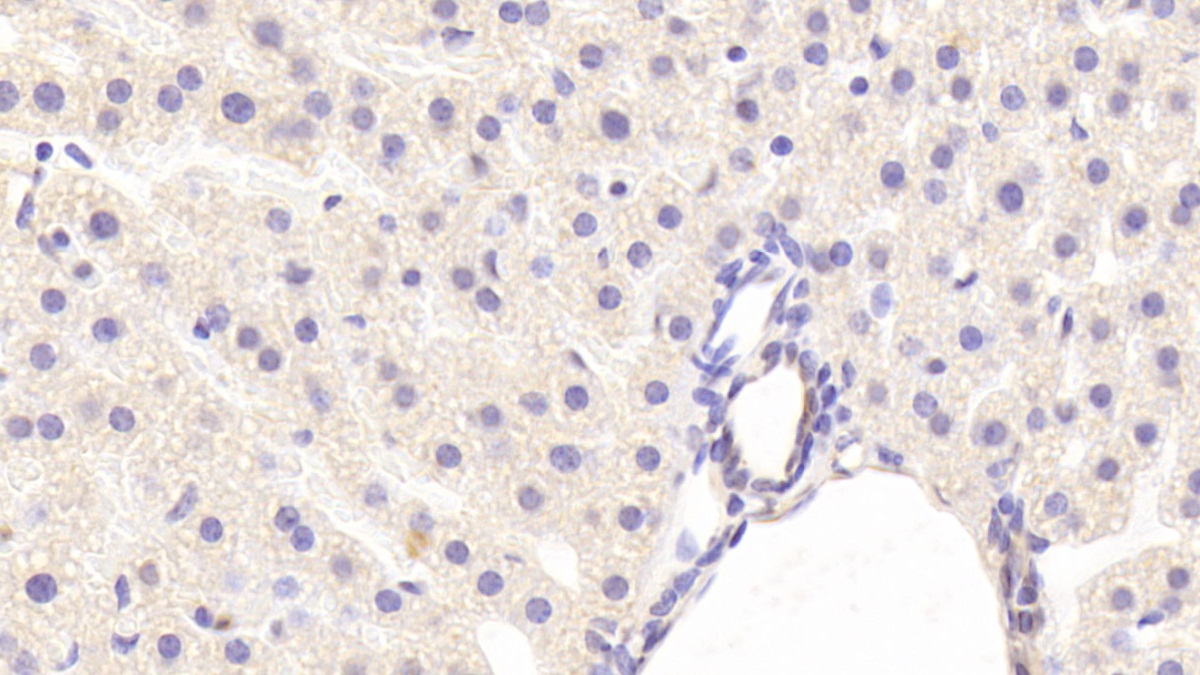 Polyclonal Antibody to Glycine Dehydrogenase (GLDC)