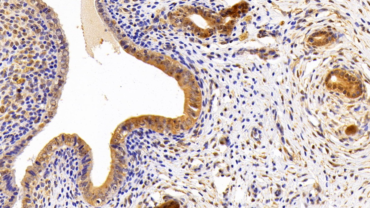 Polyclonal Antibody to Lipin 1 (LPIN1)