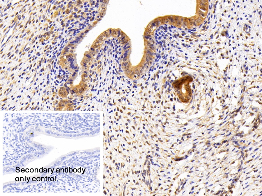 Polyclonal Antibody to Lipin 1 (LPIN1)