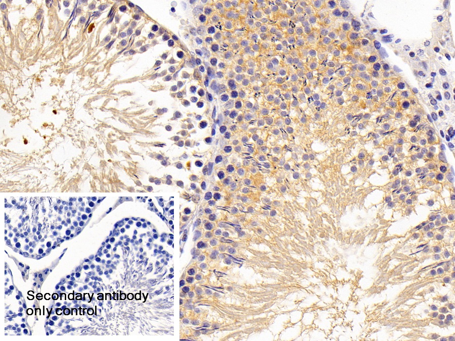 Polyclonal Antibody to Lipin 1 (LPIN1)