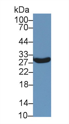 Polyclonal Antibody to Steroidogenic Acute Regulatory Protein (STAR)