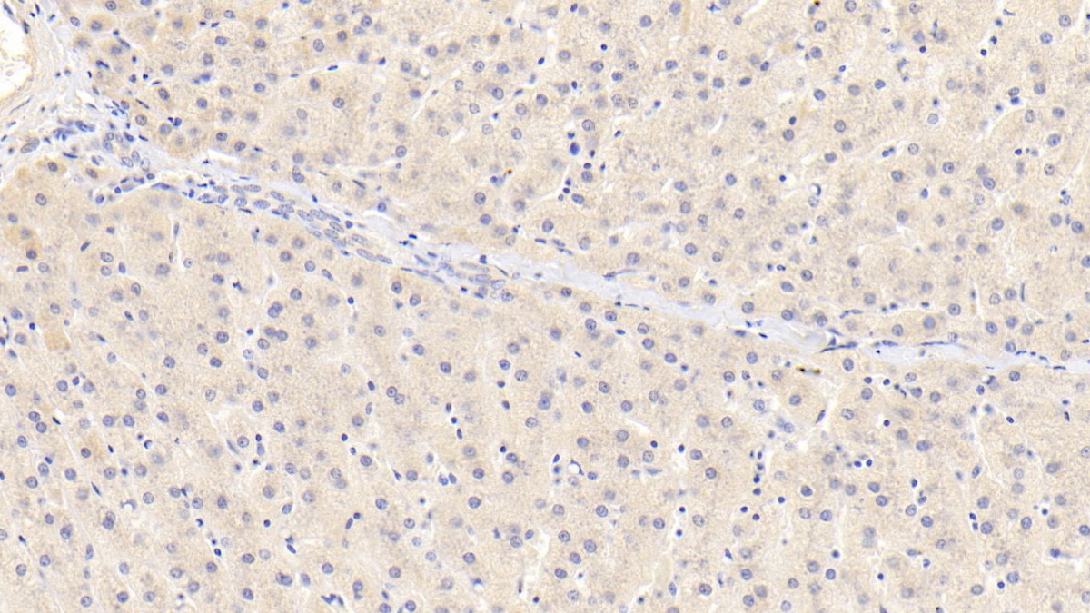 Polyclonal Antibody to Receptor Tyrosine Kinase Like Orphan Receptor 1 (ROR1)