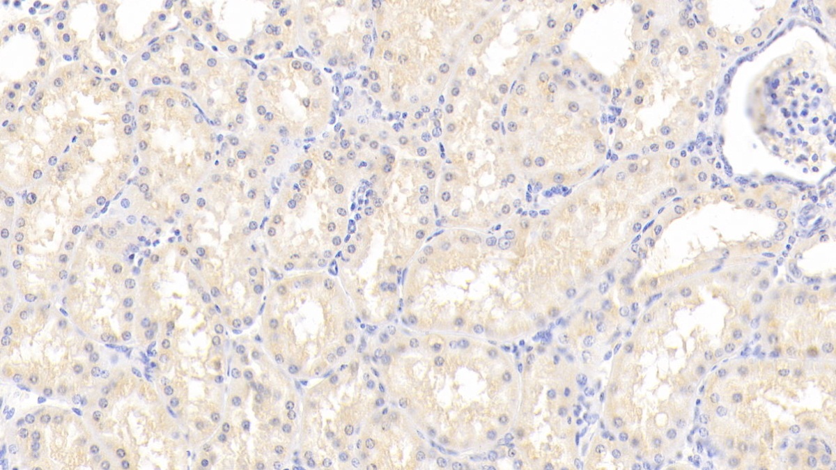 Polyclonal Antibody to Receptor Tyrosine Kinase Like Orphan Receptor 1 (ROR1)