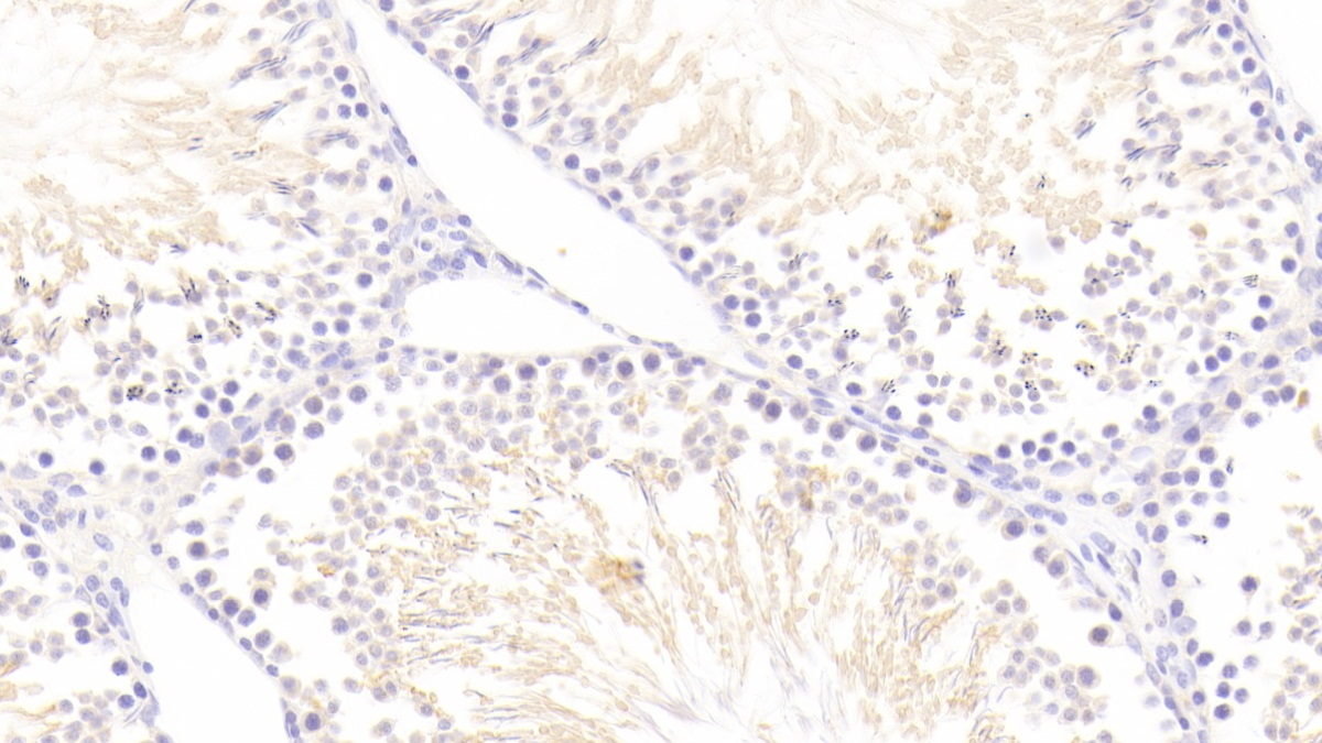 Polyclonal Antibody to Dual Serine/Threonine And Tyrosine Protein Kinase (DSTYK)