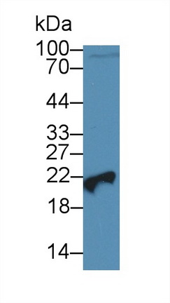 Polyclonal Antibody to Phosphatidylethanolamine Binding Protein 1 (PEBP1)