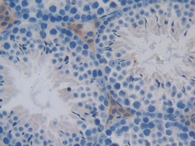 Polyclonal Antibody to Phosphoprotein Associated With Glycosphingolipid Microdomains 1 (PAG1)