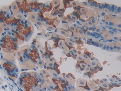 Polyclonal Antibody to Phosphoprotein Associated With Glycosphingolipid Microdomains 1 (PAG1)