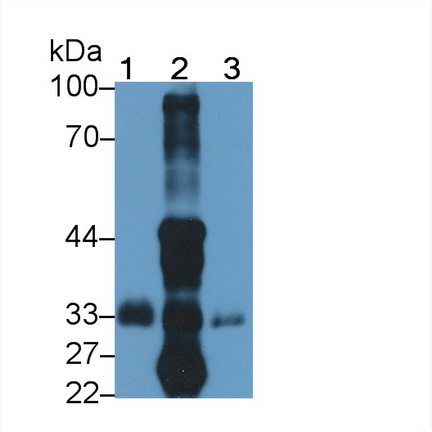 Polyclonal Antibody to Excitatory Amino Acid Transporter 4 (EAAT4)