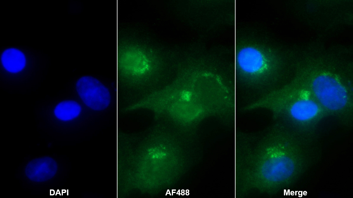 Polyclonal Antibody to Galactosylceramidase (GALC)