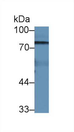 Polyclonal Antibody to Steroid Sulfatase Isozyme S (STS)