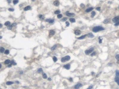 Polyclonal Antibody to Arylsulfatase A (ARSA)