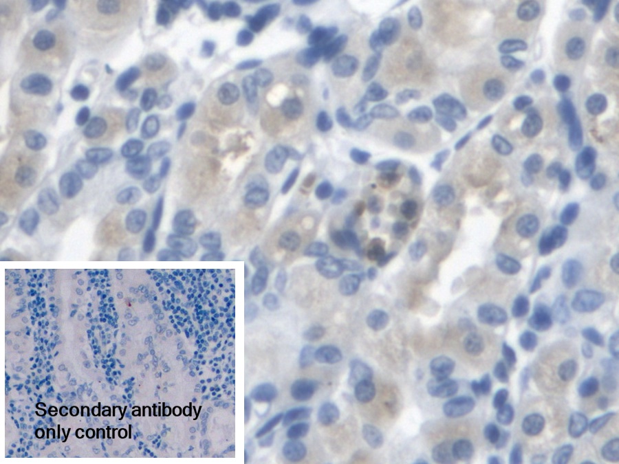 Polyclonal Antibody to Arylsulfatase A (ARSA)