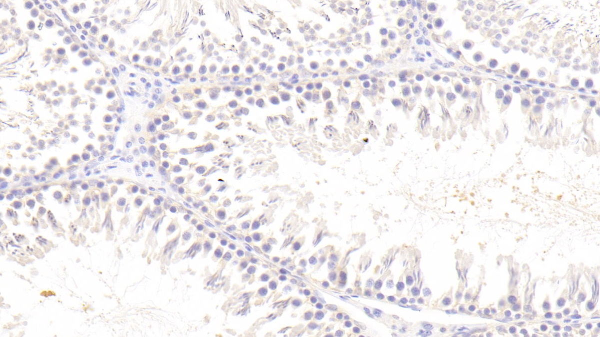 Polyclonal Antibody to Triggering Receptor Expressed On Myeloid Cells 2 (TREM2)