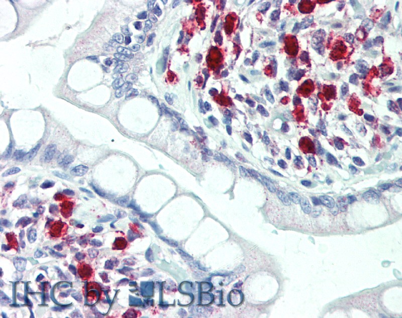 Polyclonal Antibody to Triggering Receptor Expressed On Myeloid Cells 2 (TREM2)