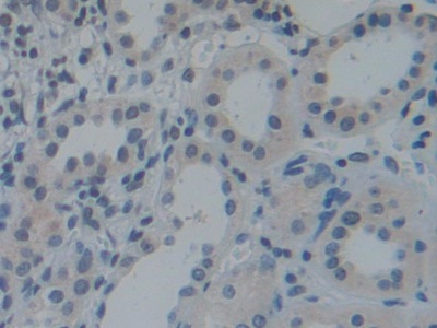 Polyclonal Antibody to Torsin 1A (TOR1A)