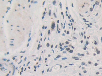 Polyclonal Antibody to Torsin 1A (TOR1A)