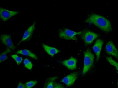 Polyclonal Antibody to Torsin 1A (TOR1A)