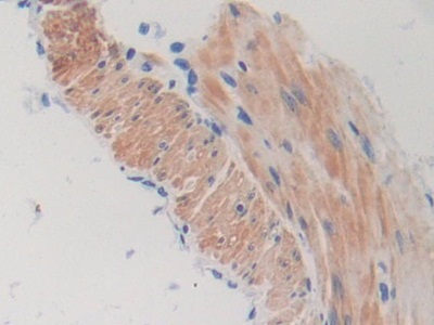 Polyclonal Antibody to Torsin 1A (TOR1A)