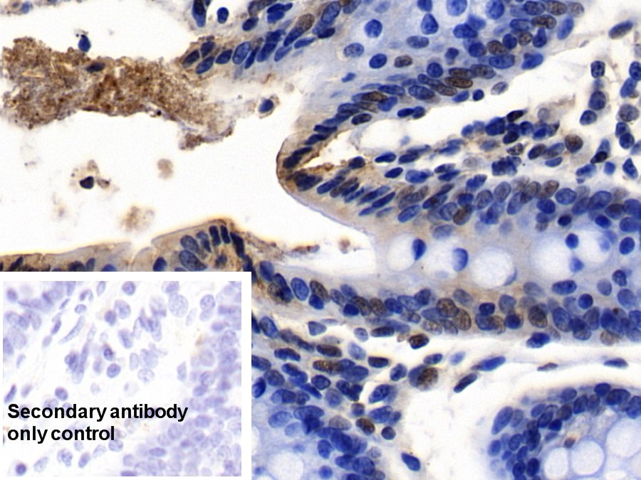 Polyclonal Antibody to Nucleolar And Coiled Body Phosphoprotein 1 (NOLC1)