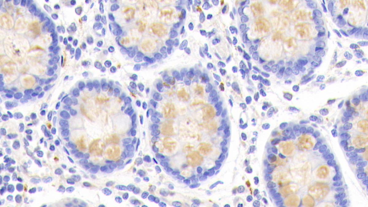 Polyclonal Antibody to Chloride Channel Accessory 1 (CLCA1)