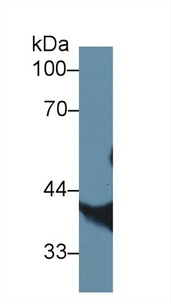 Polyclonal Antibody to Lens Epithelium Derived Growth Factor (LEDGF)