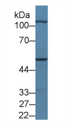 Polyclonal Antibody to Myopalladin (MYPN)