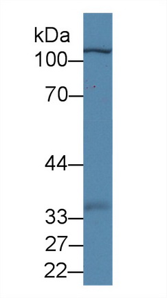 Polyclonal Antibody to Myopalladin (MYPN)